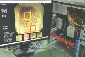 図２：大腸NBI内視鏡における画像診断支援のための病変識別システム