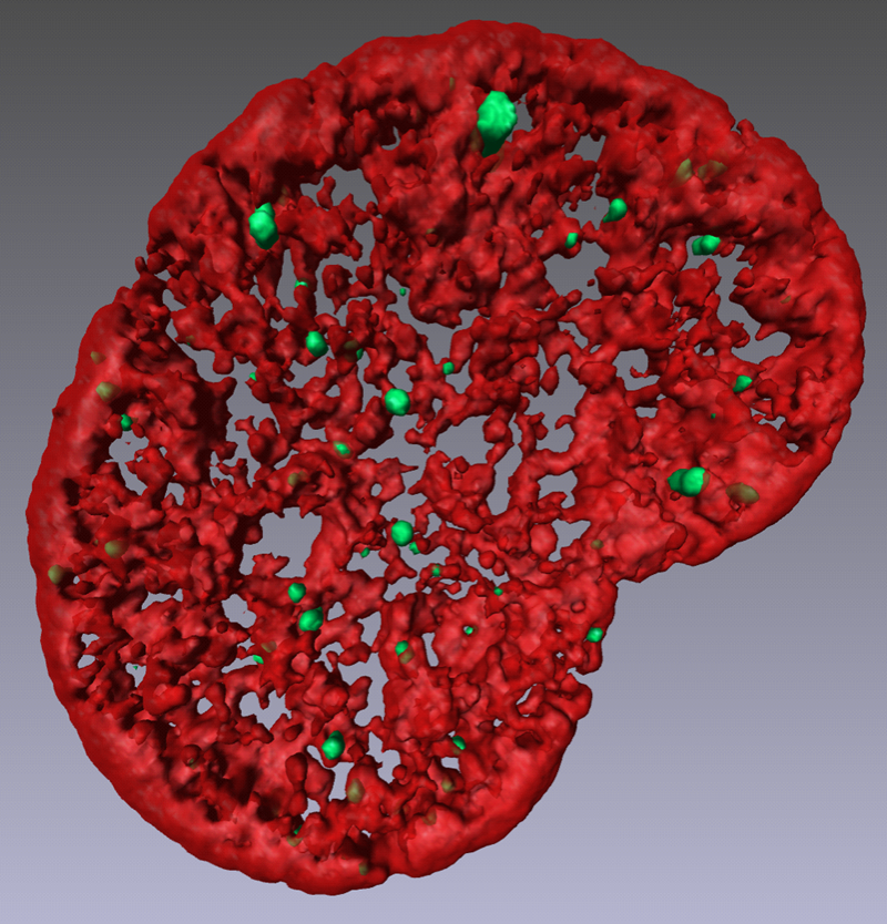 核内のDNA合成時に形成されたRAD51フォーカスの図。緑の点がRAD51の凝集点で、赤がDNAになる。