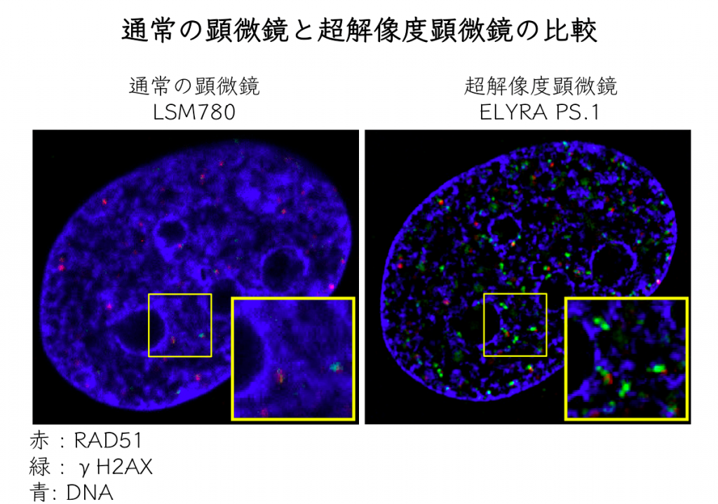 通常の顕微鏡（左）と超高解像度顕微鏡（右）の比較。赤い点がRAD51で、青がDNA。赤はγH2AXというDNA損傷箇所を検出するために用いられるタンパク質