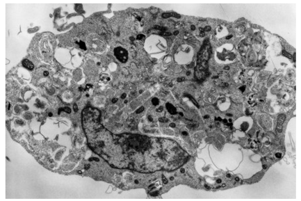 アポトーシス耐性細胞に外的ストレスとして抗がん剤を投与し，18時間後の電子顕微鏡像。細胞内に大量のオートファゴソーム（下記参照）形成がみられる。 