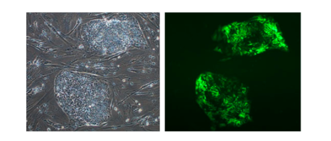 朝長教授らはすでに組換えボルナウイルス技術を応用し、核内で長期間安全に外来遺伝子を発現するボルナウイルスベクター（REVec）を開発している。写真はiPS細胞に導入されたGFP（緑色蛍光タンパク質）を発現するREVec。